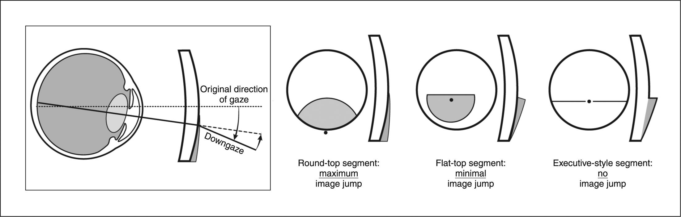 round-top